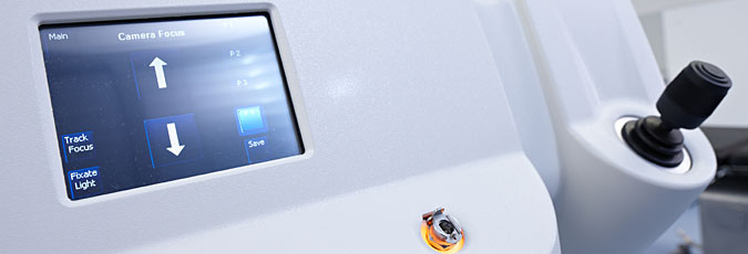 LenSx Femtosekundenlaser für Grauer Star Katarakt Operationen